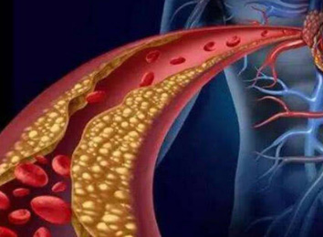 為什么酵素被譽(yù)為血管“清道夫”?